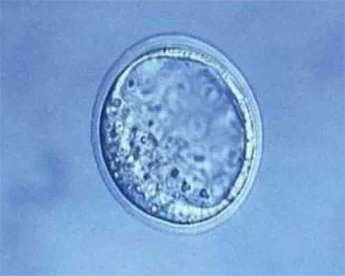 西宁41岁绝经治疗医院推荐与费用解析